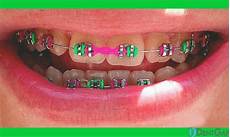 Rubber Medical Products